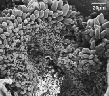 Micrografía electrónica de otoconias, partículas esenciales para el equilibrio en el oído interno humano.